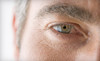 Global Laser Vision Coupons San Diego, California Deals