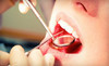 Alliance Dental & Orthodontics Coupons San Francisco, California Deals