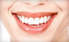 Metroplex Dental Care Coupons Carrollton, Texas Deals