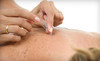 Point Flow Acupuncture Coupons St. Charles, Illinois Deals