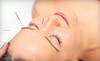 City Acupuncture Coupons New York, New York Deals