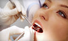 See Me Smile Dental Coupons Santa Barbara, California Deals