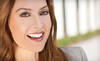 ACCU Dental Coupons San Jose, California Deals