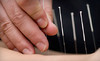 Acupuncture Together Coupons Cambridge, Massachusetts Deals