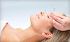 Desert Health Acupuncture and Herbal Medicine Coupons Albuquerque, New Mexico Deals