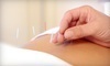 Ontario College of Traditional Chinese Medicine Coupons Markham, Ontario Deals