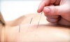 Michigan Acu Clinic Coupons Ypsilanti, Michigan Deals