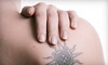 Derma-Aesthetic Laser and Electrolysis Center Coupons Carrollton, Texas Deals