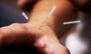 Find Your Balance Acupuncture Coupons Boulder, Colorado Deals