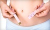 Slender Inspirations Fat Loss Coupons Niagara Falls, New York Deals