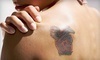 New Look Vein and Aesthetic Center Coupons St. Louis, Missouri Deals
