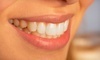Luxury Dentistry NYC Coupons New York, New York Deals